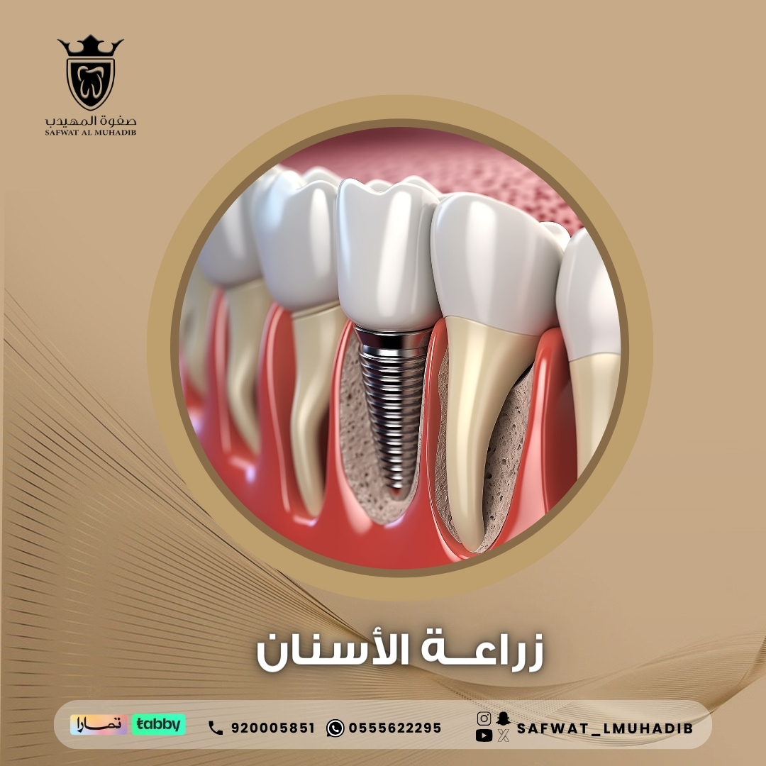 Service 1